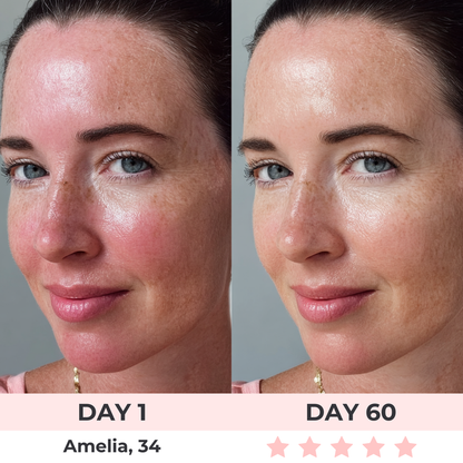 Luminous™ - LED Face Mask