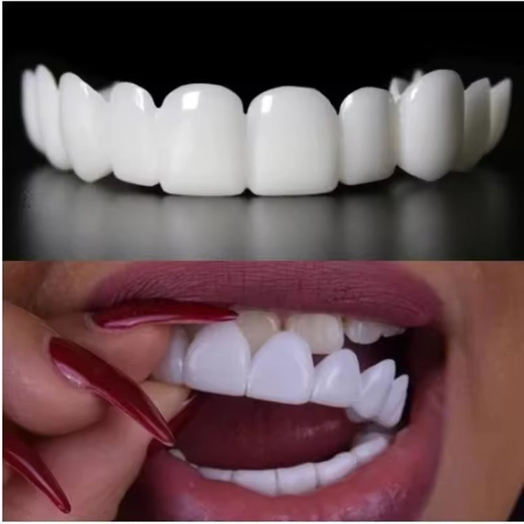 Solavane™ Snap-On Veneers