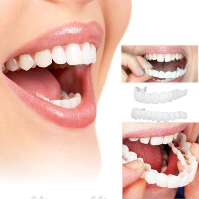 Solavane™ Snap-On Veneers